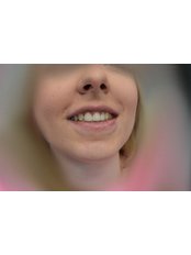CEREC Dental Restorations - Dent plus