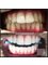 All Smiles Dentist, Century City - Smile Makeover: Laser teeth whitening 