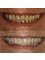 Silver Oaks Dental Clinic - Cosmetic dentistry @silveroaksdentalclinic 