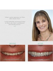 Teeth Contouring and Reshaping - Silver Oaks Dental Clinic