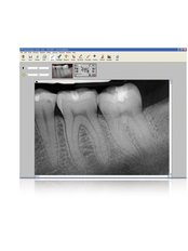 Digital Dental X-Ray - Big Red Tooth Dental Practice