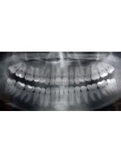 Digital Panoramic Dental X-Ray - Big Red Tooth Dental Practice