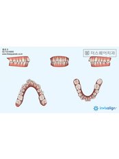 Invisalign™ - The Square Dental Clinic