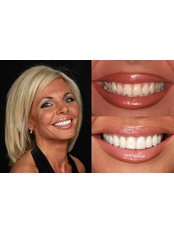 Cosmetic Dentist Consultation - Disseny de Somriures
