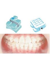 Orthodontist Consultation - Disseny de Somriures