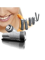 Dental Implants - Centro Dental Cotignola
