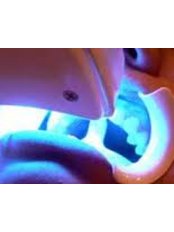 Teeth Whitening - Clinica Cristina Viyuela & CO