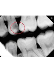 Digital Dental X-Ray - Clinica Cristina Viyuela & CO