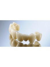 CEREC Dental Restorations - LB CLINICAS