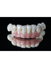 CEREC Dental Restorations - LB CLINICAS