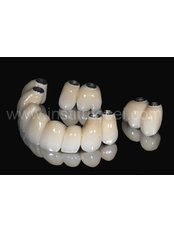 Restorative Dentist Consultation - LB CLINICAS