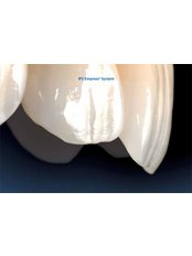 CAD/CAM Dental Restorations - LB CLINICAS
