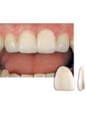 Cosmetic Dentist Consultation - Clínica Dental Cots