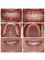 Clinica dental Dra Miralles - VICENTE LERMA 10 BAJOS . 46980 PATERNA, PATERNA. VALENCIA, VALENCIA, 46980,  6