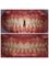 Clinica dental Dra Miralles - VICENTE LERMA 10 BAJOS . 46980 PATERNA, PATERNA. VALENCIA, VALENCIA, 46980,  3