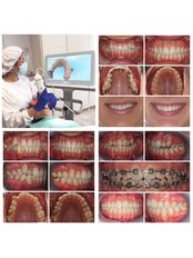 DENTIST CONSULTATION - Clinica dental Dra Miralles