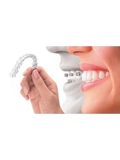 Invisalign™ - Clinique d'Orthodontie Sàrl