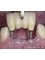 The specialty dental clinic for oral surgery & dental implant - Omar Al Mokhtar atreet, Arnoos Square, Damascus, Syria,  5