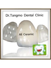 Maryland Bridge - Dr.Tangmo Dental Clinic