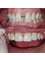 Cabinet dentaire docteur Zied Ben Hamed - 27 AV Habib BOURGUIBA IMMEUBLE NOUICER 2 éme étage B23, SOUSSE, SOUSSE, 4000,  20