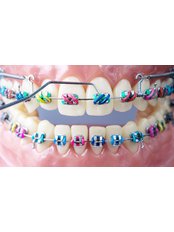 Orthodontics - Doctor Bayar