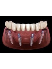 All-on-4 Dental Implants - ACARDENT TURKEY