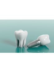 Dental Implants - ACARDENT TURKEY