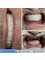 Akdeniz İnci Dental Clinic - Dental Implants 