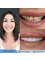 Akdeniz İnci Dental Clinic - Laminate Veneers 