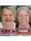 Akdeniz İnci Dental Clinic - Metal Supported Porcelain Crowns/Implants 