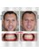 Antalya Ortodonti Ağız ve Diş Sağlığı Polikliniği - Yeşilbahçe Mah. Metin Kasapoğlu Cad. 2. Baysal Apt. 67/4, Antalya, Muratpaşa,  18