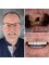 Atalya Dental Clinic - Çağlayan mah. Barınaklar bulvarı. no: 16, Muratpaşa, Antalya, Muratpaşa, 07040,  9
