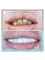Center Dental Clinic - Altindag mah. Gulluk str. No:95-C, Antalya, Muratpasa, 07050,  5