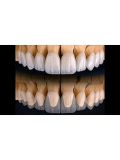 Dental Crowns - DCI Dental Clinic