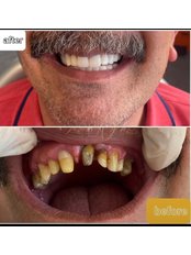 Dentist Consultation - Dena Clinic