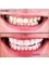 Dental Net Turkey - Teeth-Before After 
