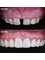 Dental Net Turkey - Teeth-Before After 