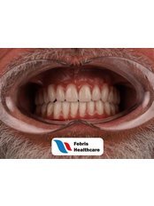 Total Prosthesis (Dentures) - Febris Healthcare- Dental