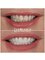 Panoramik  Dental Clinic Turkey - çağlayan mah.bülent ecevit bulv.parkresidance evl a blok no:112/b, Muratpaşa, Antalya, 07230,  3