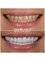 Panoramik  Dental Clinic Turkey - çağlayan mah.bülent ecevit bulv.parkresidance evl a blok no:112/b, Muratpaşa, Antalya, 07230,  4