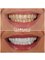 Panoramik  Dental Clinic Turkey - çağlayan mah.bülent ecevit bulv.parkresidance evl a blok no:112/b, Muratpaşa, Antalya, 07230,  8