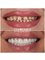 Panoramik  Dental Clinic Turkey - çağlayan mah.bülent ecevit bulv.parkresidance evl a blok no:112/b, Muratpaşa, Antalya, 07230,  5