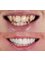 Safe Dent Dental Clinic -Dr Yesim Ramos - Metin kasapoglu cad Armada Apt no:44, Kat:2 D: 2-3, Antalya, 0700,  18
