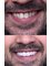 Safe Dent Dental Clinic -Dr Yesim Ramos - Metin kasapoglu cad Armada Apt no:44, Kat:2 D: 2-3, Antalya, 0700,  20