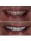Safe Dent Dental Clinic -Dr Yesim Ramos - Metin kasapoglu cad Armada Apt no:44, Kat:2 D: 2-3, Antalya, 0700,  19