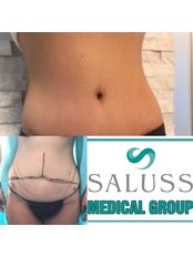 Tummy Tuck - Saluss Medical Group