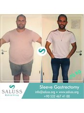 Gastric Bypass - Saluss Medical Group