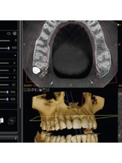 Dental X-Ray - VK Smile Dental Clinic