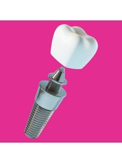 Dental Implants - VK Smile Dental Clinic