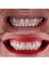 Side Dental Centre - eski hisar mah. demokrasi bulv. 9501 sok . no1 /11 manavgat, whatsapp contact please : +905419521086 && +905060930091, ANTALYA, MANAVGAT, 07600,  5
